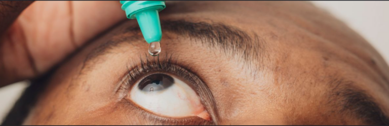 Image of a person applying eye drops to an irritated eye while treating conjunctivitis (Apollo)