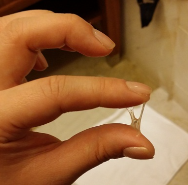 This is a close-up image of clear vaginal discharge stretched between a woman's thumb and index finger, illustrating the appearance of cervical mucus.